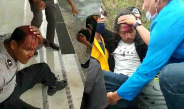 Massa Aksi Banyak Terluka, BEM Hukum Unidayan Minta Pertanggungjawaban Polri